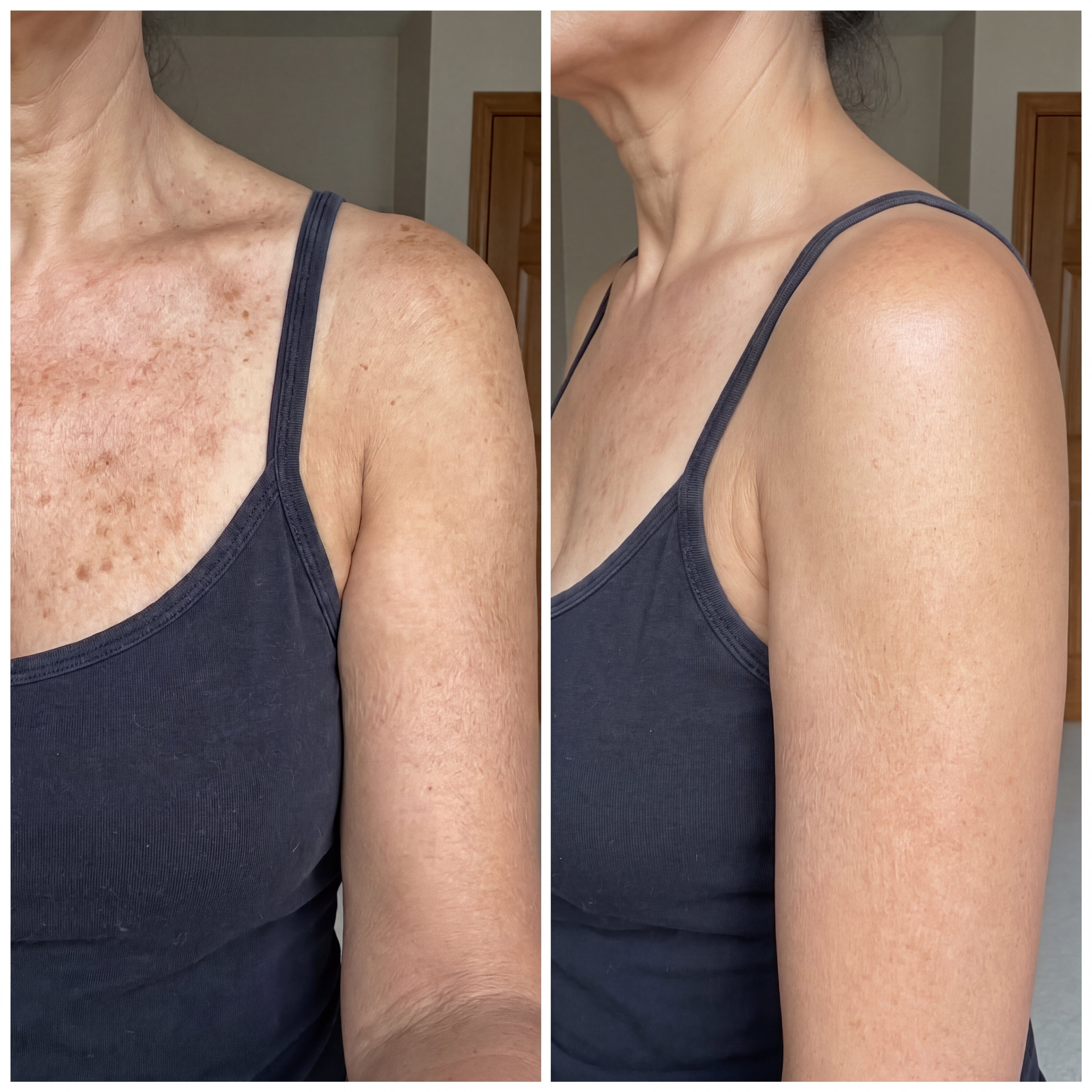 After 8 customer before and after comparison, both panels shown