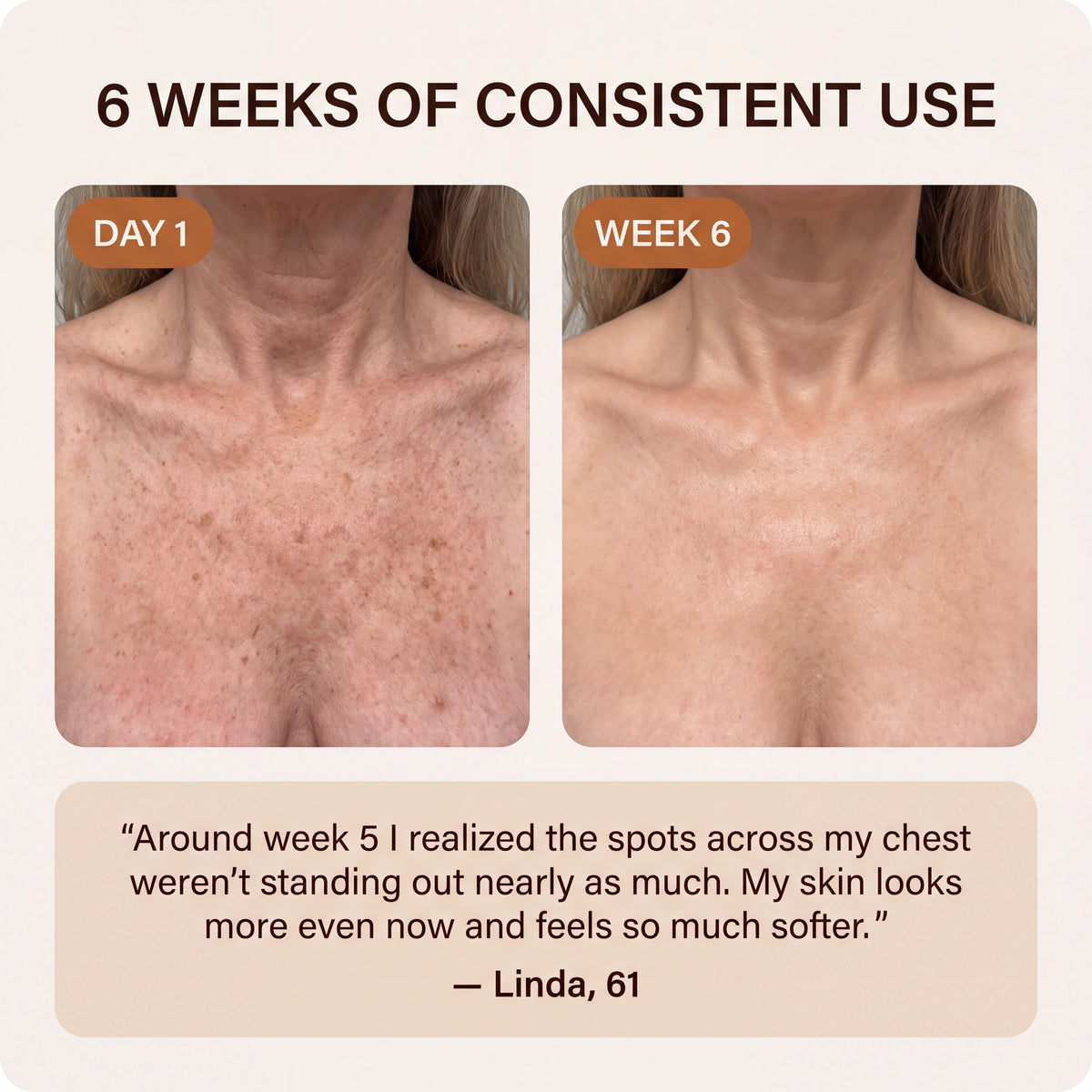After 8 Tone Correcting Body Oil